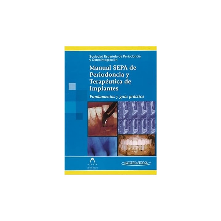 Manual SEPA de Periodoncia y Terapéutica de Implantes. Vol.(2)